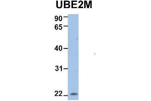 Host:  Rabbit  Target Name:  UBE2M  Sample Type:  Human 721_B  Antibody Dilution:  1.
