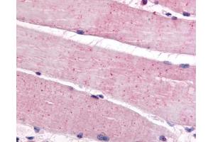 Anti-BEST3 antibody IHC of human skeletal muscle. (Bestrophin 3 anticorps  (C-Term))