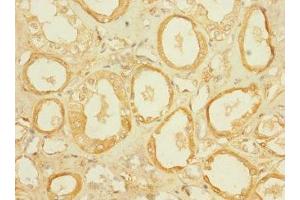 Immunohistochemistry of paraffin-embedded human kidney tissue using ABIN7170015 at dilution of 1:100 (SLC5A2 anticorps  (AA 335-422))