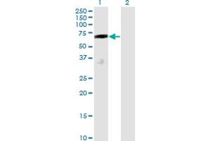 Western Blot analysis of DCP1A expression in transfected 293T cell line by DCP1A monoclonal antibody (M01), clone 2D12. (DCP1A anticorps  (AA 186-285))