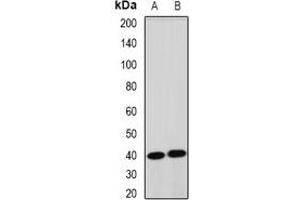 Western blot analysis of TERE1 expression in mouse liver (A), rat heart (B) whole cell lysates. (UBIAD1 anticorps)