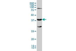 GALT monoclonal antibody (M01), clone 4C11 Western Blot analysis of GALT expression in K-562 .