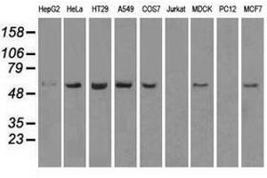 Image no. 6 for anti-Transmembrane Protein 100 (TMEM100) antibody (ABIN1501422) (TMEM100 anticorps)