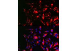 Immunofluorescence analysis of U2OS cells using RRM2 Rabbit pAb (ABIN6129715, ABIN6147265, ABIN6147266 and ABIN6220890) at dilution of 1:150 (40x lens). (RRM2 anticorps  (AA 1-389))