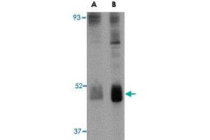 Western blot analysis of WNT10B in human skeletal muscle tissue lysate with WNT10B polyclonal antibody  at (A) 2 and (B) 4 ug/mL . (WNT10B anticorps  (Internal Region))
