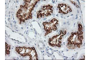 Image no. 2 for anti-Adaptor-Related Protein Complex 2, mu 1 Subunit (AP2M1) (AA 97-383) antibody (ABIN1491720)