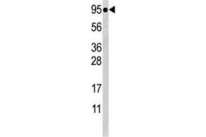Western Blotting (WB) image for anti-Signal Transducer and Activator of Transcription 5A (STAT5A) (pSer726) antibody (ABIN2970978) (STAT5A anticorps  (pSer726))