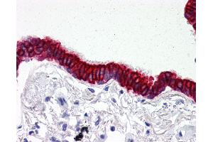 Anti-SCO2 antibody IHC of human lung, respiratory epithelium. (SCO2 anticorps  (C-Term))