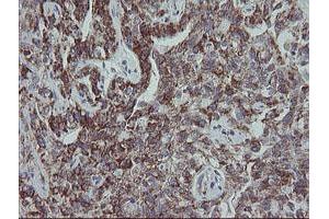 Image no. 11 for anti-Mitochondrial Ribosomal Protein S27 (MRPS27) (AA 151-414) antibody (ABIN1490963)