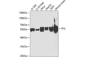 Western blot analysis of extracts of various cell lines using TFG Polyclonal Antibody at dilution of 1:1000. (TFG anticorps)