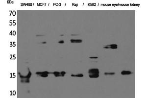 Western Blotting (WB) image for anti-MK (Internal Region) antibody (ABIN5956379) (MK (Internal Region) anticorps)