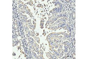 IHC analysis of MOV10 using anti-MOV10 antibody (ABIN7600236). (MOV10 anticorps  (AA 167-772))