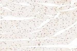 Immunohistochemistry analysis of paraffin-embedded mouse heart using,APRIL (ABIN7072887) at dilution of 1: 1200