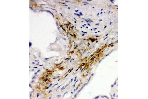 Anti-MAdCAM1 antibody, IHC(F) IHC(F): Human Placenta Tissue