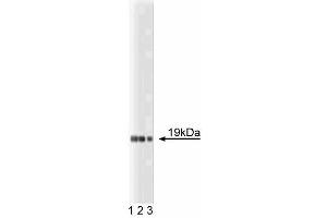 Western blot analysis of Telethonin of mouse heart lysate. (TCAP anticorps  (AA 1-167))