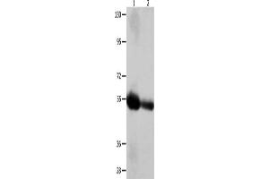 Gel: 10 % SDS-PAGE, Lysate: 60 μg, Lane 1-2: Human liver cancer tissue, Human bladder carcinoma tissue, Primary antibody: ABIN7128892(CEACAM1 Antibody) at dilution 1/400, Secondary antibody: Goat anti rabbit IgG at 1/8000 dilution, Exposure time: 2 minutes