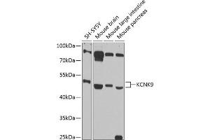Western blot analysis of extracts of various cell lines, using KCNK9 antibody (ABIN6128568, ABIN6142756, ABIN6142758 and ABIN6216267) at 1:1000 dilution. (KCNK9 anticorps  (AA 265-374))