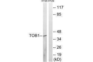 Western blot analysis of extracts from HT-29 cells, treated with serum (20 % , 15 mins), using TOB1 (Ab-164) antibody. (Protein Tob1 (TOB1) (Ser164) anticorps)