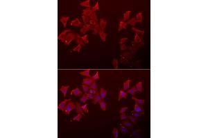 Immunofluorescence analysis of A549 cells using LECT1 antibody (ABIN5973998). (LECT1 anticorps)