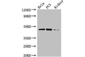 Western Blot Positive WB detected in: Hela whole cell lysate, PC-3 whole cell lysate, Mouse kidney tissue All lanes: GSK3B antibody at 3 μg/mL Secondary Goat polyclonal to rabbit IgG at 1/50000 dilution Predicted band size: 47, 49 kDa Observed band size: 47 kDa (GSK3 beta anticorps  (AA 1-420))