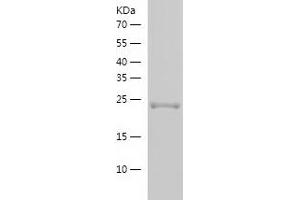 Western Blotting (WB) image for RAB5B, Member RAS Oncogene Family (RAB5B) (AA 1-215) protein (His-IF2DI Tag) (ABIN7124760)