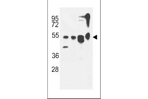 ATG13 Antibody (N-term) (ABIN653882 and ABIN2843129) western blot analysis in MDA-M,CEM,T47D cell line and mouse cerebellum tissue lysates (35 μg/lane). (ATG13 anticorps  (N-Term))