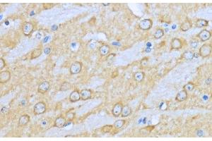 Immunohistochemistry of paraffin-embedded Mouse brain using HSP90AA1 Polyclonal Antibody at dilution of 1:200 (40x lens).
