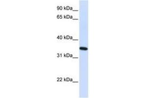 Image no. 1 for anti-Reticulon 1 (RTN1) (AA 36-85) antibody (ABIN6741062) (Reticulon 1 anticorps  (AA 36-85))