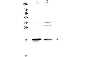 Western blot analysis of MAP1LC3A using anti-MAP1LC3A antibody . (MAP1LC3A anticorps  (AA 1-120))