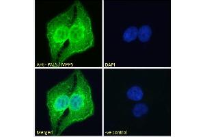 ABIN185150 Immunofluorescence analysis of paraformaldehyde fixed U2OS cells, permeabilized with 0.