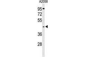 Western blot analysis of GPSN2 (arrow) in A2058 cell line lysates (35ug/lane) using TECR / GPSN2  (TECR anticorps  (C-Term))