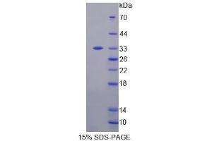 Image no. 1 for Homeodomain Interacting Protein Kinase 3 (HIPK3) (AA 1-264) protein (His tag) (ABIN6239715) (HIPK3 Protein (AA 1-264) (His tag))