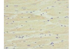 Immunohistochemistry of paraffin-embedded human heart tissue using ABIN7171975 at dilution of 1:100