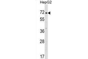 Western Blotting (WB) image for anti-Zinc Finger Protein 155 (ZNF155) antibody (ABIN2999111) (ZNF155 anticorps)