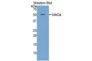 Western Blotting (WB) image for anti-Plasminogen Activator, Urokinase Receptor (PLAUR) (AA 15-211) antibody (FITC) (ABIN1860909)