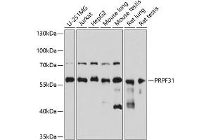 Western blot analysis of extracts of various cell lines, using PRPF31 antibody (ABIN6132996, ABIN6146262, ABIN6146264 and ABIN6221399) at 1:3000 dilution. (PRPF31 anticorps  (AA 1-200))