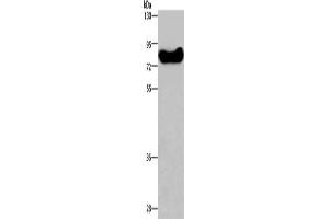 Gel: 8 % SDS-PAGE, Lysate: 40 μg, Lane: HepG2 cells, Primary antibody: ABIN7129183(DDX43 Antibody) at dilution 1/200, Secondary antibody: Goat anti rabbit IgG at 1/8000 dilution, Exposure time: 1 minute (DDX43 anticorps)