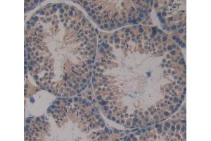 Used in DAB staining on fromalin fixed paraffin- embedded Kidney tissue