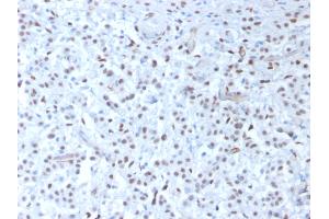 ABIN6383829 to WT1 was successfully used to stain nuclei in sections of human mesothelioma and in human and rat testis sections. (Recombinant WT1 anticorps)