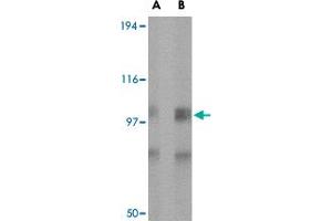 Western blot analysis of GRIK1 in rat brain tissue lysate with GRIK1 polyclonal antibody  at (A) 0. (GRIK1 anticorps  (Internal Region))