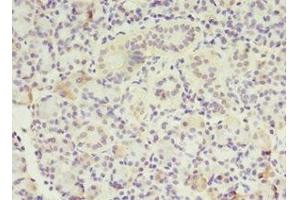 Immunohistochemistry of paraffin-embedded human pancreatic tissue using ABIN7159589 at dilution of 1:100 (MTRR anticorps  (AA 1-725))