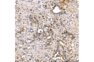 IHC analysis of Alpha 2 Antiplasmin/SERPINF2 using anti-Alpha 2 Antiplasmin/SERPINF2 antibody (ABIN7601808). (alpha 2 Antiplasmin anticorps  (AA 461-491))