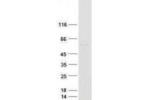 Validation with Western Blot