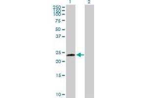 Western Blot analysis of UBE2T expression in transfected 293T cell line by UBE2T MaxPab polyclonal antibody. (Ube2t anticorps  (AA 1-197))