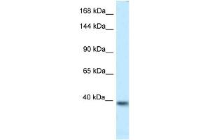 WB Suggested Anti-Kcnq2 Antibody   Titration: 1. (KCNQ2 anticorps  (Middle Region))