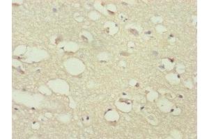 Immunohistochemistry of paraffin-embedded human brain tissue using ABIN7169284 at dilution of 1:100