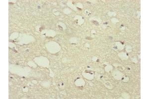 Immunohistochemistry of paraffin-embedded human brain tissue using ABIN7169284 at dilution of 1:100 (PPP2R3C anticorps  (Regulatory Subunit B))