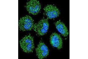 Confocal immunofluorescent analysis of PRAMEF6 Antibody (C-term)(Cat#AP53435PU-N) with NCI-H460 cell followed by Alexa Fluor 488-conjugated goat anti-rabbit lgG (green). (PRAMEF6 anticorps  (C-Term))