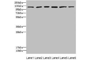 Western blot All lanes: UBE4A antibody at 2. (UBE4A anticorps  (AA 797-1066))