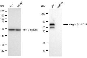 Western blotting analysis using Integrin beta-1/CD29 antibody (ABIN7799067).